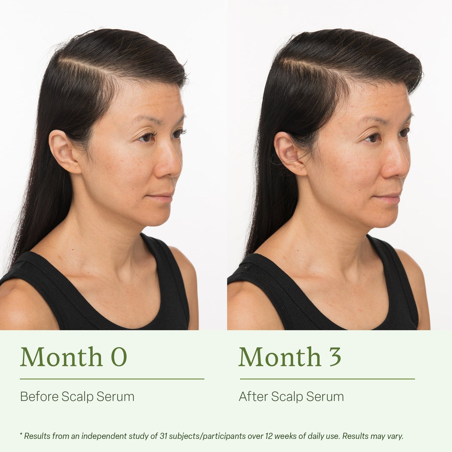 Divi Scalp Serum