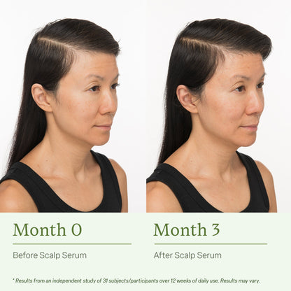 Divi Scalp Serum